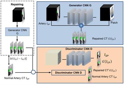 The Optimal Tetralogy of Fallot Repair Using Generative Adversarial Networks